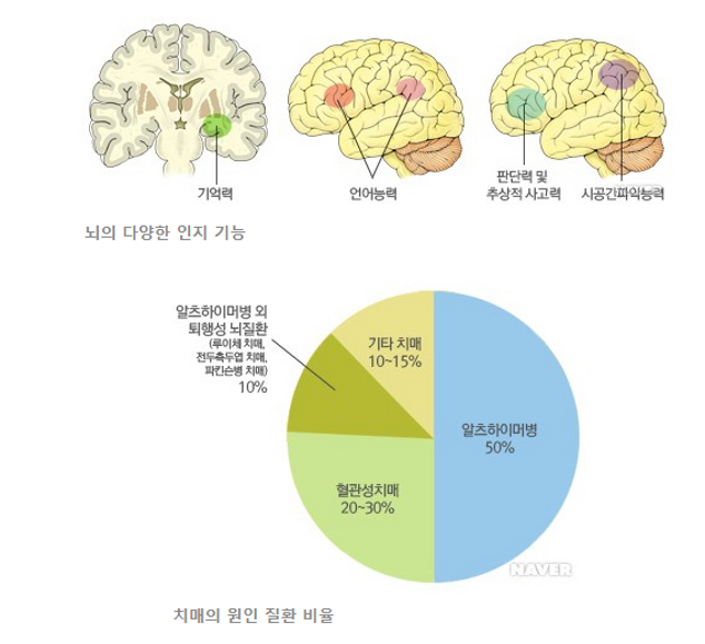 건강보험 심사평가원 자료에 따르면, 치매의 원인질환은 알츠하이머병이 50%, 혈관성 치매 20~30%, 기타 치매 10~15%, 루이체 치매, 전두측두엽 치매, 파킨스병 치매와 같은 알츠하이머병 외 퇴행성 뇌질환 10%의 비율로 나타났습니다